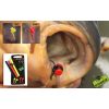 Fox EDGES™ Zig Aligna™ - Kit (red/yellow/black) Horogbefordító